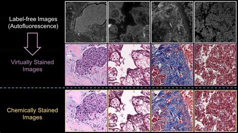 Deep Learning Based Virtual Histology Staining Of Unlabelled Tissue