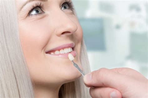 Todo Lo Que Debes Saber Sobre Las Carillas De Porcelana Estudi Dental