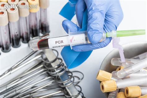 Scientists Hand Holding A Test Tube With Blood Sample For Pcr Test