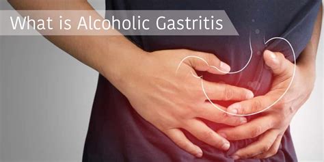 How Can Alcohol Be A Serious Cause Of Stomach Pain Article Abode