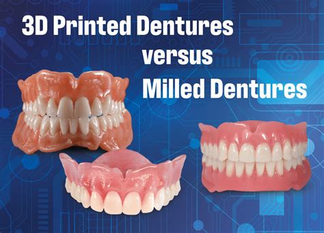 3D Printed vs. Milled Dentures | Elegant Lab