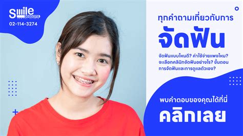 จัดฟัน คืออะไร ราคาเท่าไหร่ มีกี่แบบ รวมข้อมูลการจัดฟันที่ต้องรู้