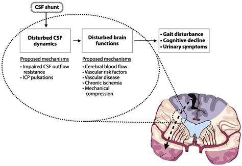 Diagnosis And Treatment Of Idiopathic Normal Pressure Hydroc Continuum Lifelong Learning