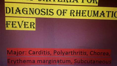 Jones Criteria For Diagnosis Of Rheumatic Fever Youtube