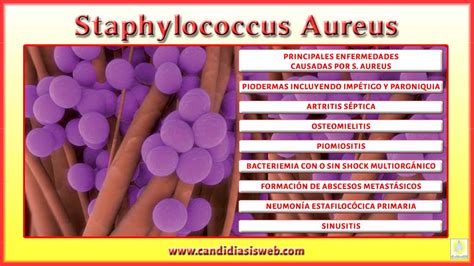 Qu Es Staphylococcus Aureus