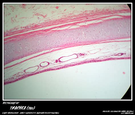 Trachea Cartilage Histology