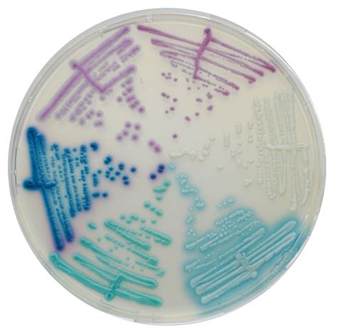 Chromagar™ Candida Plus Chromagar