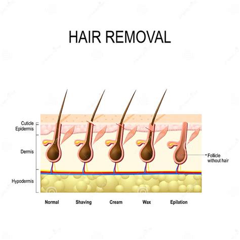 Hair Removal Stock Vector Illustration Of Care Epilation 84073842