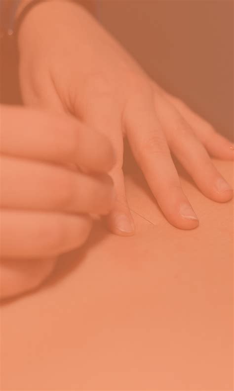 Myofasciale Therapie Dry Needling Re Activity Tel