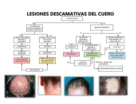 Enfermedades Del Cuero Cabelludo 3 Principales Que Debes Cuidar