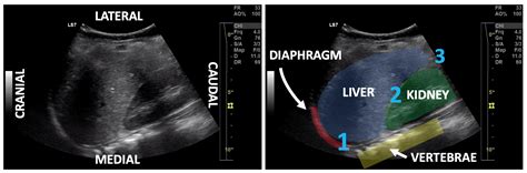 upper quadrant kidsono