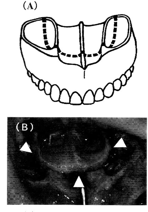 Figure 1 From Reliability Of Superior Repositioning And Postoperative