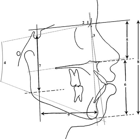 Skeletal Angular Measurements 1 Sna Angle 2 Snb Angle 3 Anb Download Scientific Diagram