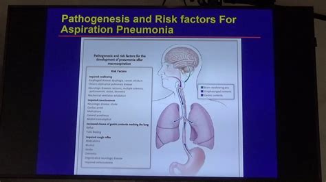 Pathophysiology Of Aspiration Pneumonia