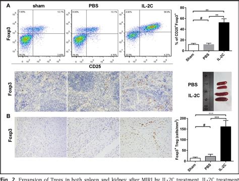 The Il Anti Il Complex Attenuates Cardiac Ischaemia Reperfusion