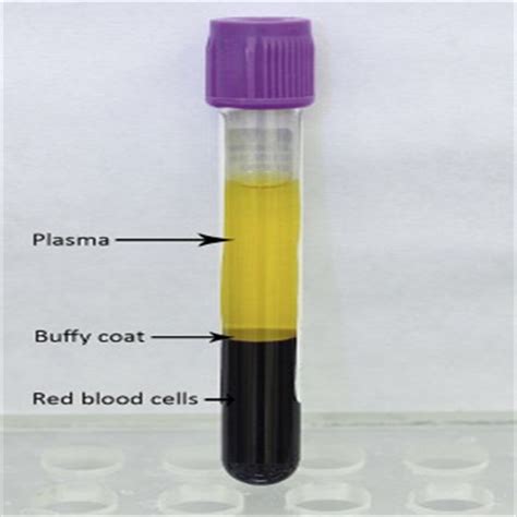 buffy coat  centrifuged blood manufacturer supplier  china mke