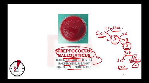 15 Streptococcus Gallolyticus Youtube