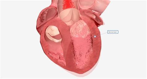 Understanding Average Settlements For Soft Tissue Injuries In Car