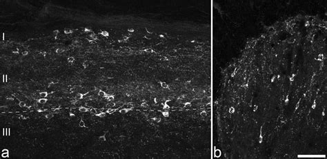 Characterization Of Neurons That Express Preprotachykinin B In The