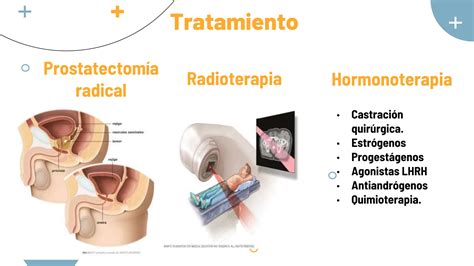 Hiperplasia Prost Tica Benigna Y C Ncer De Pr Stata Ppt