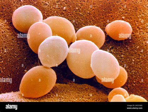 Yeast Cells Coloured Scanning Electron Micrograph Sem Of Budding