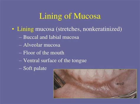 Ppt Oral Mucosa Dhy114 Week 1 Powerpoint Presentation Id6929210