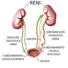 Pielonefrite Descrizione Della Patologia Ed Approfondimenti