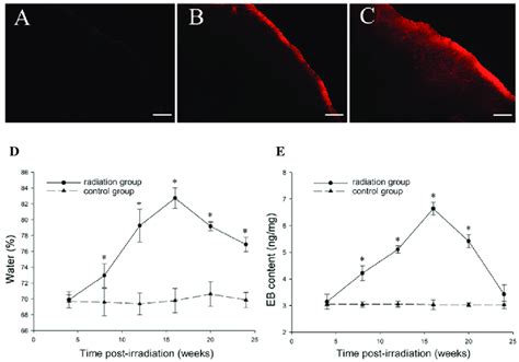 Representative Results Of Brain Water Content And Eb Extravasation