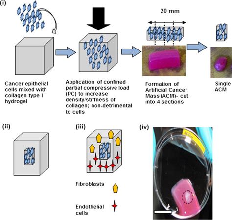 Schematic Demonstrating Construction Of The 3 D In Vitro Cancer Model