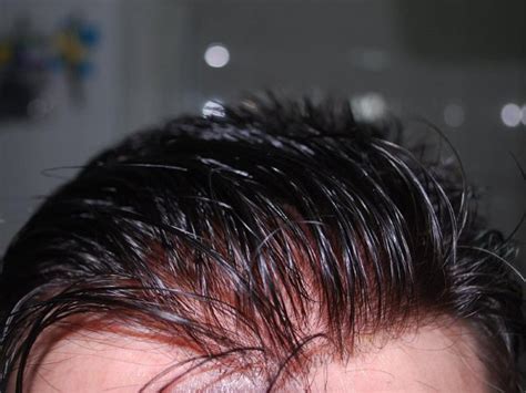 Protesi Capelli Uomo Newlacecu Newlacecu