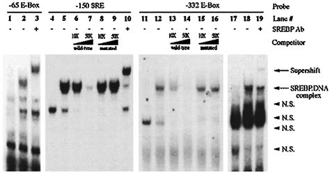 Nutritional Regulation Of The Fatty Acid Synthase Promoter In Vivo