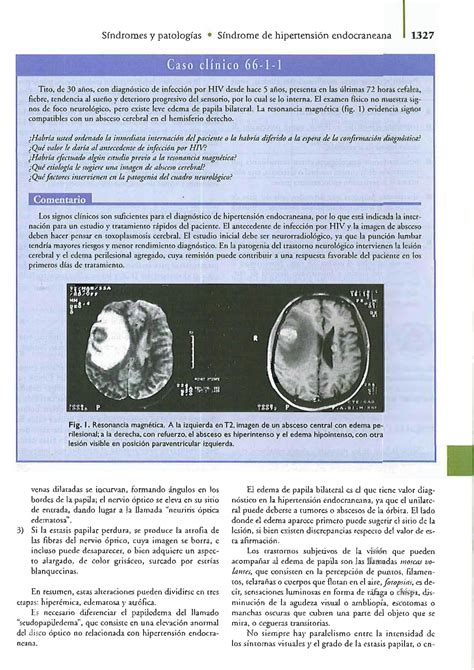 Solution S Ndromes Neurol Gicos Studypool