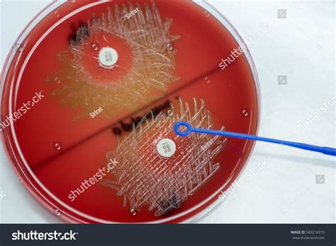 Optochin Subsensitivity Test On Blood Agar Stock Photo 583216915