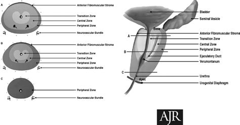 Prostate Gland Location Diagram