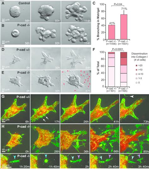 Loss Of P Cadherin Causes Precocious Branching Morphogenesis In