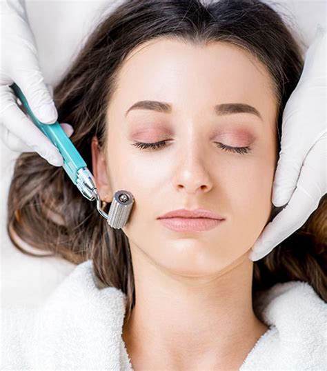 Microneedling à Créteil Médecin Esthétique And Laser Jm Estetic 94