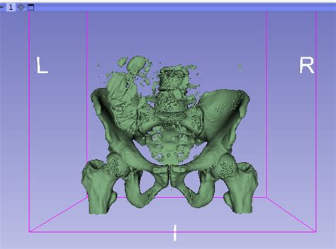 Dicom Image Orientation Incorrect When Imageorientationpatient Is 1 0 0 0 1 0 Support 3d