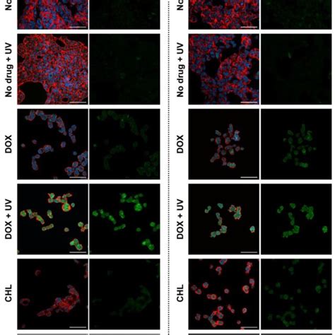 Confocal Imaging Of COLO 829 A And G 361 B Melanotic Melanoma Cells