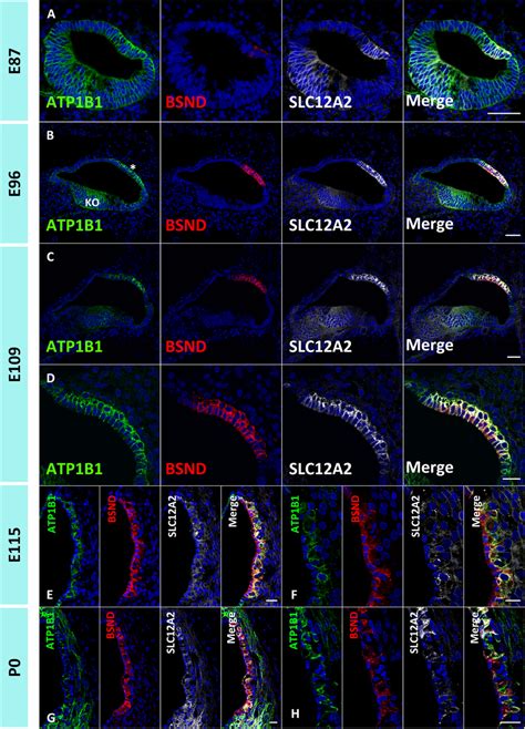 Atp B Expression Patterns In The Marginal Cells Of The Stria