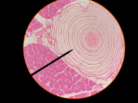 Pacinian corpuscle Diagram | Quizlet