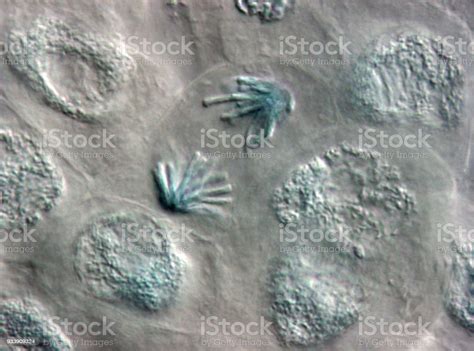 Microscope Image Of Plant Cells Stained For Nuclei Stock Photo