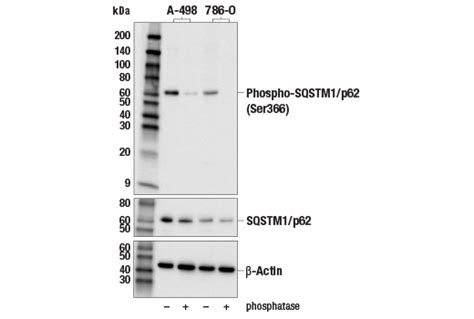 Phospho Sqstm1p62 Ser366 Antibody Cell Signaling Technology