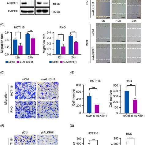 Alkbh1 Accelerates Colorectal Cancer Crc Cell Migration And Invasion