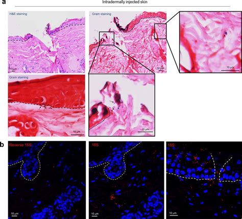 Intradermal Injection Leads To Bacterial Translocation From The Download Scientific Diagram