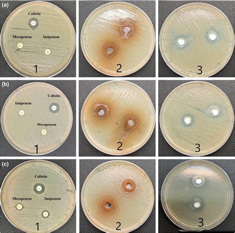 Eco Friendly Drugs Induce Cellular Changes In Colistin Resistant Bacteria