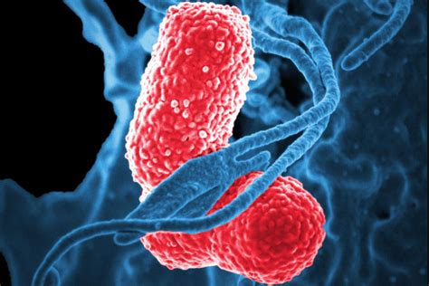 Mengenal Pneumonia Indonesia Peringkat Ke 7 Dunia Kematian Balita