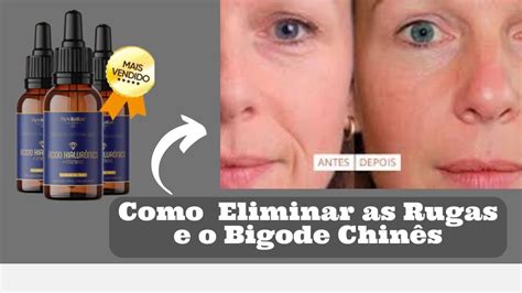 Revitalize Hialuronic em Gotas é bom pra Pele como Funciona