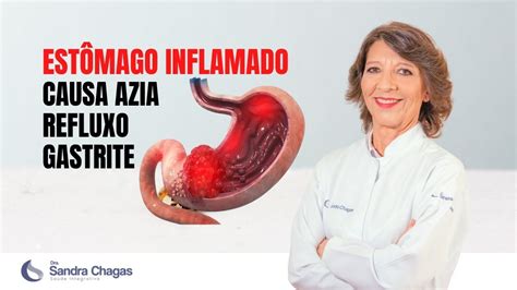 ESTÔMAGO INFLAMADO CAUSA AZIA REFLUXO E GASTRITE YouTube