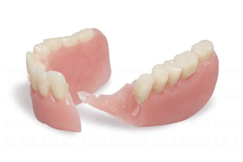 Denture Repair Things You Need To Know European Denture Center