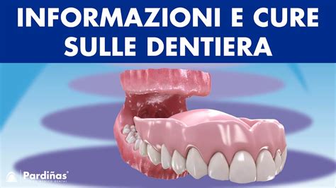 PROTESI MOBILE TOTALE Informazioni E Cure Sulle DENTIERA YouTube